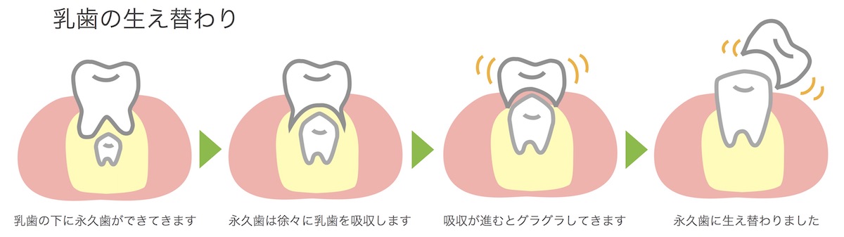乳歯の生え替わり